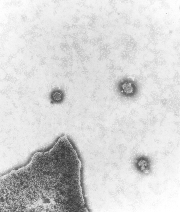 Akabane virus infection